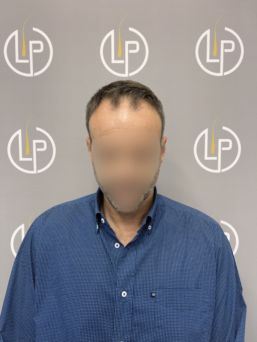 Περιστατικό 2 — πριν