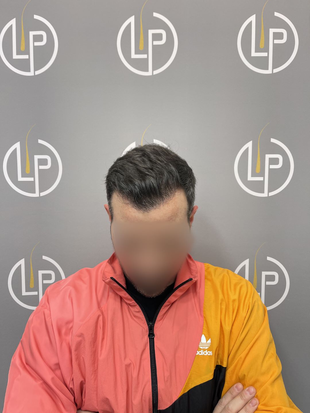 Περιστατικό 3 — μετά