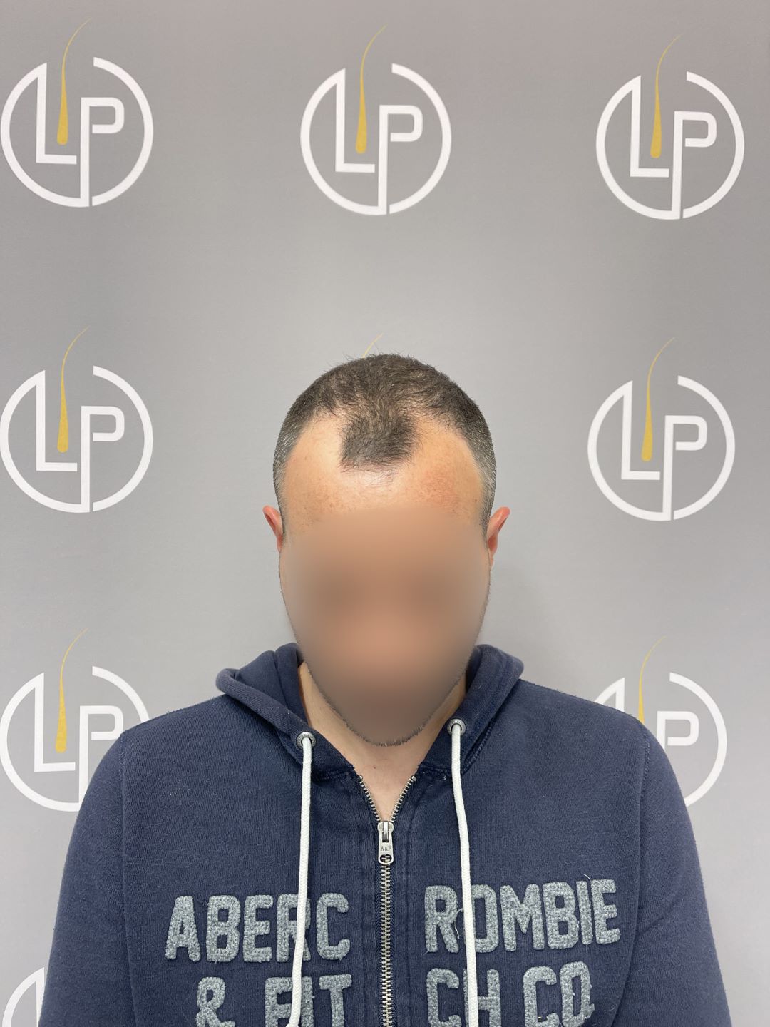 Περιστατικό 3 — πριν