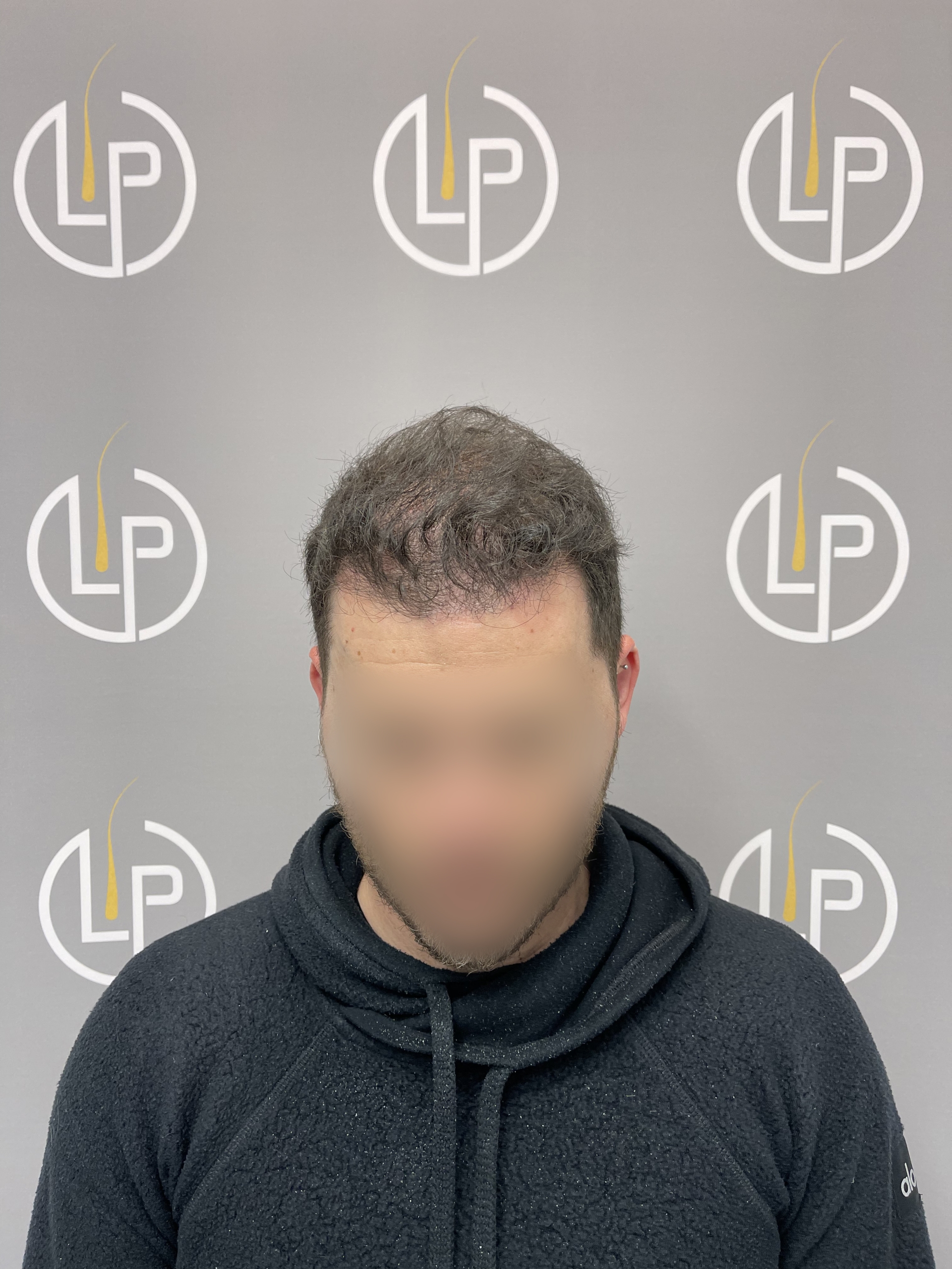 Περιστατικό 5 — μετά