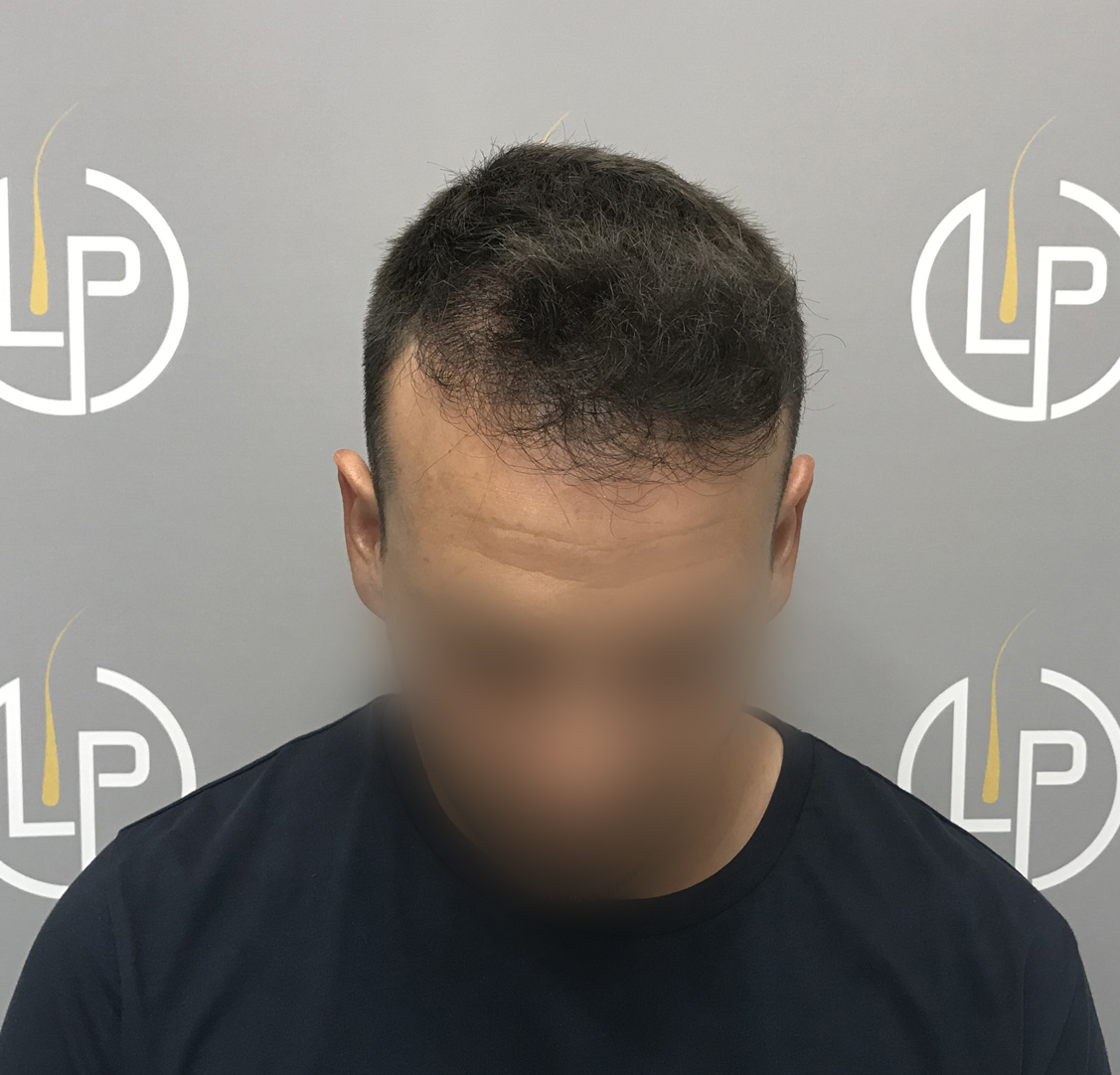 Περιστατικό 6 — μετά